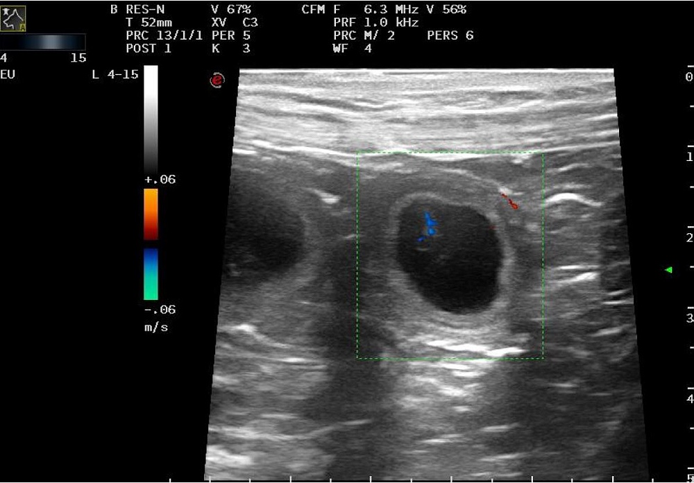 Ultraschall 3